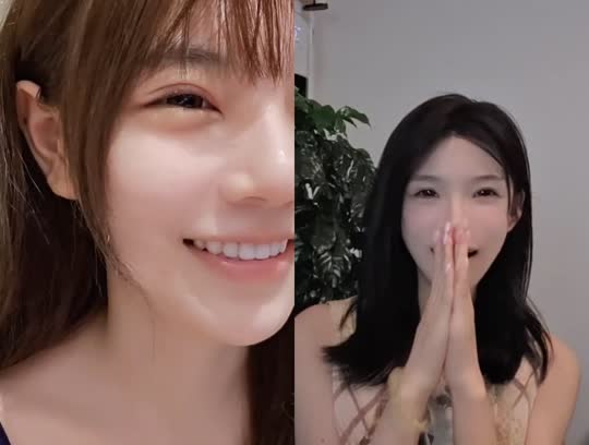 日常 眼睛肿了