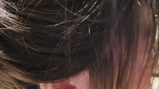 麦粒肿版图一一害羞脸红少女心事